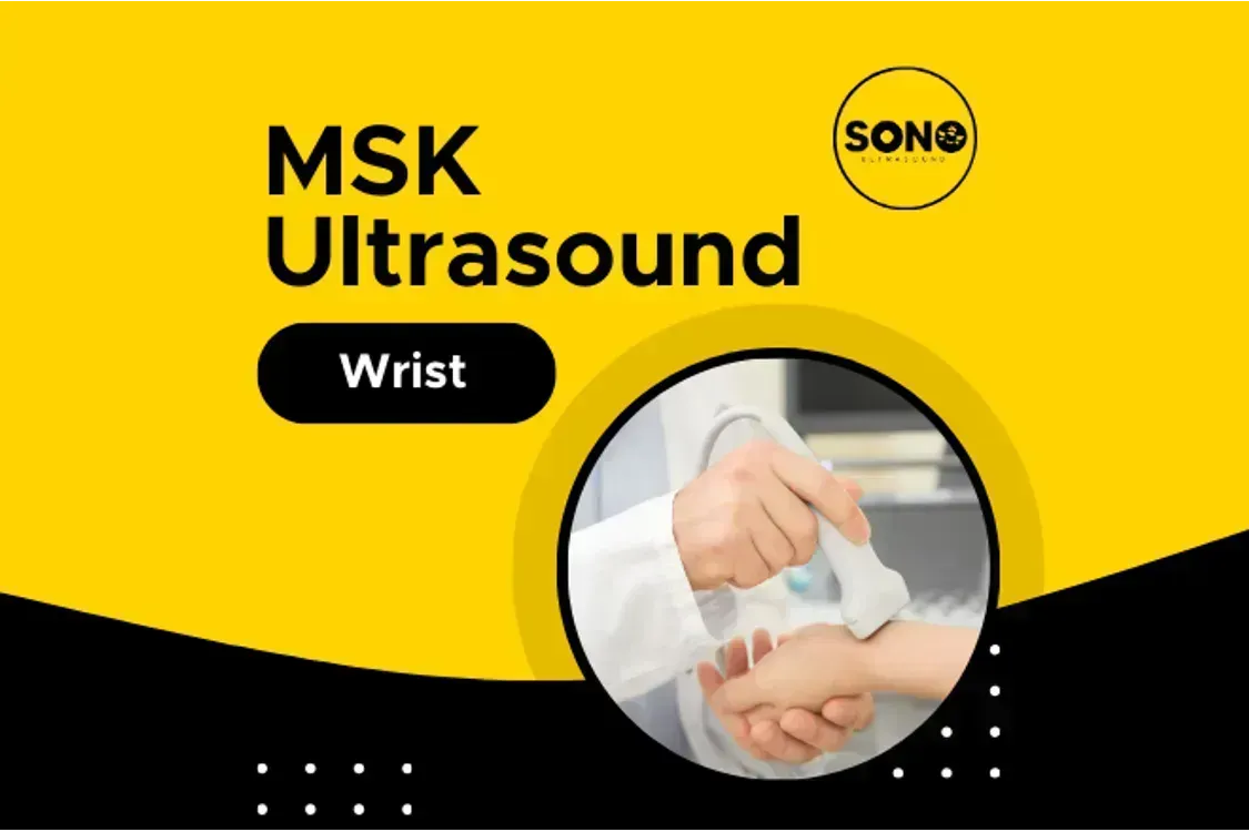 Wrist MSK Scan Malaysia
